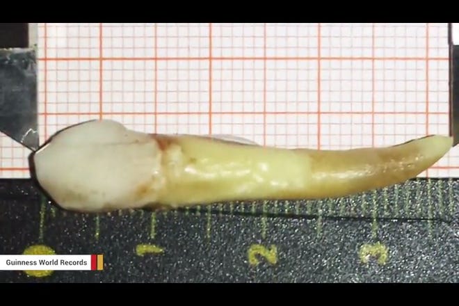 Dr. Max Lukas from Germany extracted this 1.46-inch giant tooth and earned himself a Guinness World Records title for pulling the world ’ s longest known human tooth.